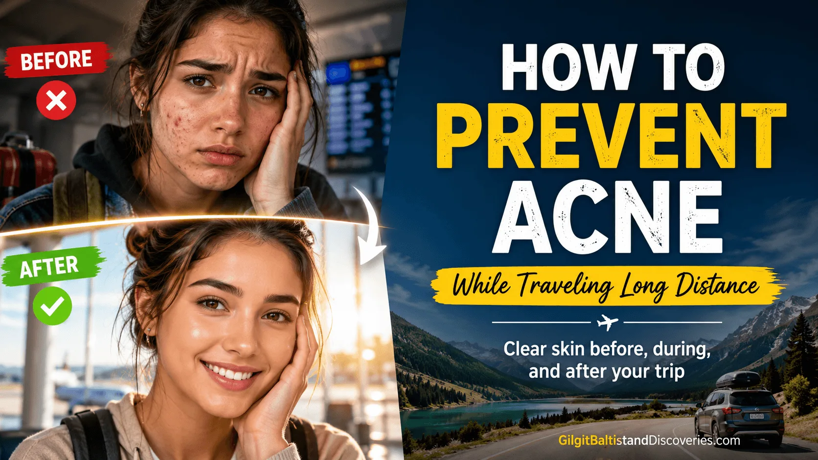 How to Prevent Acne Breakouts While Traveling Long Distance The Complete Travel Skin Guide